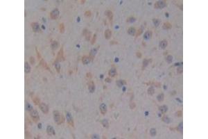 IHC-P analysis of Kidney tissue, with DAB staining. (PTK2B 抗体  (AA 704-941))