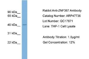 WB Suggested Anti-ZNF367  Antibody Titration: 0. (ZNF367 抗体  (C-Term))