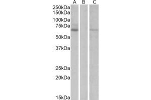 HEK293 lysate (10ug protein in RIPA buffer) over expressing Human MKRN1 with DYKDDDDK tag probed with Makorin Antibody  (1 µg/ml) in Lane A and probed with anti- DYKDDDDK Tag (1/1000) in lane C. (MKRN1 抗体  (Internal Region))