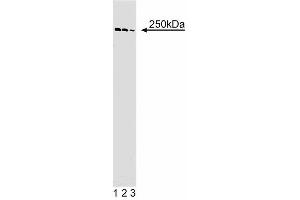 Western blot analysis of alpha-Spectrin II on Jurkat cell lysate. (SPTAN1 抗体  (AA 252-371))