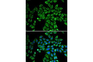 Immunofluorescence analysis of HeLa cells using ANGPT2 antibody. (Angiopoietin 2 抗体)