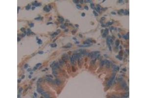Immunohistochemistry (IHC) image for anti-Amiloride Binding Protein 1 (Amine Oxidase (Copper-Containing)) (ABP1) (AA 176-328) antibody (ABIN1173375)