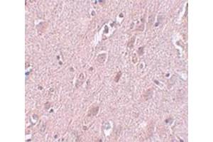 Immunohistochemical staining of human brain tissue with ZC3H12B polyclonal antibody  at 5 ug/mL dilution. (ZC3H12B 抗体  (N-Term))