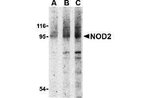 Western Blotting (WB) image for anti-Nucleotide-Binding Oligomerization Domain Containing 2 (NOD2) (N-Term) antibody (ABIN1031482) (NOD2 抗体  (N-Term))