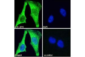 ABIN1590087 Immunofluorescence analysis of paraformaldehyde fixed HeLa cells, permeabilized with 0. (ATF6 抗体  (AA 437-449))