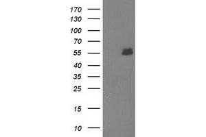 Image no. 1 for anti-U-Box Domain Containing 5 (UBOX5) (AA 1-130), (AA 419-487) antibody (ABIN1490571) (UBOX5 抗体  (AA 1-130, AA 419-487))