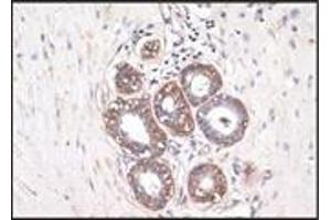 Immunohistochemistry (IHC) image for anti-S-100 (C-Term) antibody (ABIN870446) (S-100 抗体  (C-Term))