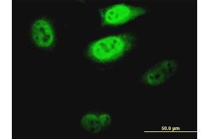 Immunofluorescence of monoclonal antibody to KLF1 on HeLa cell. (KLF1 抗体  (AA 183-237))