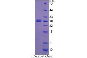Image no. 1 for Sialidase 1 (Lysosomal Sialidase) (NEU1) (AA 141-286) protein (His tag,SUMO Tag) (ABIN1080361) (NEU1 Protein (AA 141-286) (His tag,SUMO Tag))