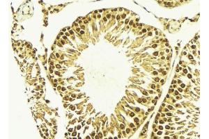 ABIN6269047 at 1/100 staining Mouse testis tissue by IHC-P. (IKBKB 抗体)