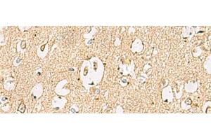 Immunohistochemistry of paraffin-embedded Human brain tissue using LRRC28 Polyclonal Antibody at dilution of 1:60(x200) (LRRC28 抗体)