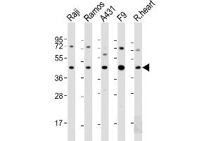 All lanes : Anti-MCL1 Antibody (BH3 Domain Specific) at 1:2000 dilution Lane 1: Raji whole cell lysate Lane 2: Ramos whole cell lysate Lane 3: A431 whole cell lysate Lane 4: F9 whole cell lysate Lane 5: A20 whole cell lysate Lysates/proteins at 20 μg per lane. (MCL-1 抗体  (AA 191-226))