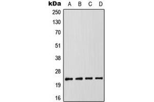 Western blot analysis of RAIDD expression in MCF7 (A), K562 (B), SP2/0 (C), PC12 (D) whole cell lysates. (CRADD 抗体  (Center))