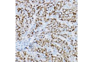 Immunohistochemistry of paraffin-embedded rat ovary using P2RY14 Rabbit pAb (ABIN6131673, ABIN6145126, ABIN6145127 and ABIN6224204) at dilution of 1:200 (40x lens). (P2RY14 抗体  (AA 209-338))