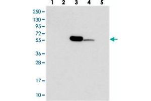 Western blot analysis of Lane 1: RT-4, Lane 2: U-251 MG, Lane 3: Human Plasma, Lane 4: Liver, Lane 5: Tonsil with C11orf80 polyclonal antibody  at 1:250-1:500 dilution. (C11ORF80 抗体)