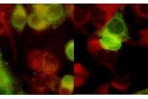 Immunofluorescence (IF) image for anti-Herpes Simplex Virus, Glycoprotein B (HSV gB) antibody (ABIN265573) (HSV gB 抗体)