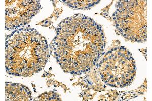 ABIN6259457 and ABIN6275785 at 1/100 staining Mouse testis tissue by IHC-P. (Phospholipase C beta 2 抗体  (Internal Region))