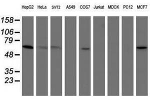 Image no. 5 for anti-Phosphoglucomutase 3 (PGM3) antibody (ABIN1500178)