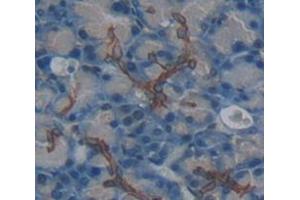 Used in DAB staining on fromalin fixed paraffin- embedded Kidney tissue (IL20RA 抗体  (AA 273-543))