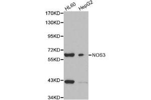 Western blot analysis of extracts of various cell lines, using NOS3 antibody. (ENOS 抗体  (AA 1-120))