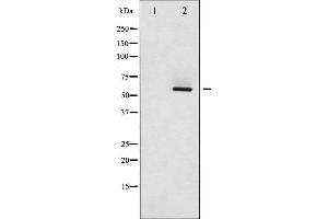 Western blot analysis of Src phosphorylation expression in COLO205 whole cell lysates,The lane on the left is treated with the antigen-specific peptide. (Src 抗体  (pSer75))