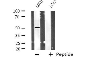 Western blot analysis of extracts from LOVO cells using POLD3 antibody. (POLD3 抗体  (C-Term))