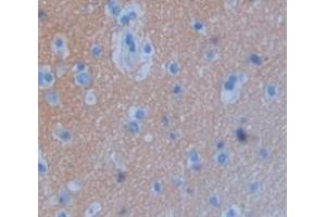 IHC-P analysis of Human Tissue, with DAB staining. (GLDC 抗体  (AA 627-833))