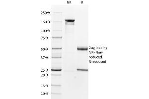 SDS-PAGE Analysis Purified Beta-2-Microglobulin Mouse Monoclonal Antibody (B2M/961). (beta-2 Microglobulin 抗体)
