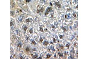 Used in DAB staining on fromalin fixed paraffin-embedded Liver tissue (GATA1 抗体  (AA 42-292))