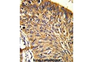 Immunohistochemistry (IHC) image for anti-Peroxiredoxin 3 (PRDX3) antibody (ABIN3001722) (Peroxiredoxin 3 抗体)