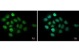 ICC/IF Image MTA1 antibody [C1C3] detects MTA1 protein at nucleus by immunofluorescent analysis. (MTA1 抗体)