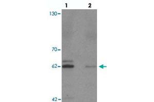 Western blot analysis of KCNK13 in rat brain tissue with KCNK13 polyclonal antibody  at 0. (KCNK13 抗体  (Internal Region))