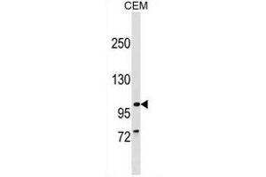PTHB1 Antibody (C-term) (ABIN1537602 and ABIN2849688) western blot analysis in CEM cell line lysates (35 μg/lane). (BBS9 抗体  (C-Term))