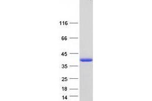 Western Blotting (WB) image for Tropomyosin 1 (Alpha) (TPM1) (Transcript Variant 1) protein (Myc-DYKDDDDK Tag) (ABIN2734383)