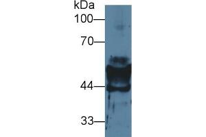 Western Blotting (WB) image for anti-Keratin 14 (KRT14) (AA 1-484) antibody (ABIN7442804)