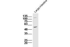Lane 1: Mouse intestine lysates probed with ZnT-1 Polyclonal Antibody, Unconjugated  at 1:300 overnight at 4˚C. (SLC30A1 抗体  (AA 131-330))