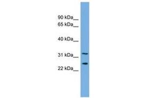 Image no. 1 for anti-Zinc Finger Protein 265 (Zranb2) (AA 143-192) antibody (ABIN6744705) (ZNF265 抗体  (AA 143-192))