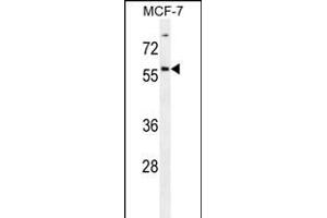ZN Antibody (Center) (ABIN656186 and ABIN2845514) western blot analysis in MCF-7 cell line lysates (35 μg/lane). (ZNF165 抗体  (AA 215-242))