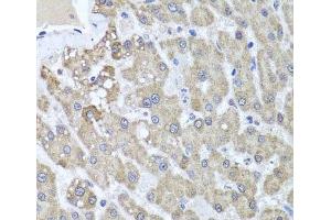 Immunohistochemistry of paraffin-embedded Human liver damage using ALKBH4 Polyclonal Antibody at dilution of 1:100 (40x lens). (ALKBH4 抗体)