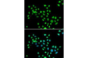 Immunofluorescence analysis of U20S cell using H2AFY antibody. (H2AFY 抗体)