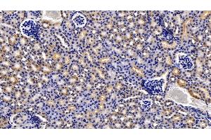 Immunohistochemistry (IHC) image for anti-Insulin-Degrading Enzyme (IDE) (AA 753-973) antibody (ABIN7434305)