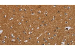 Immunohistochemistry of paraffin-embedded Human brain using CSH1 Polyclonal Antibody at dilution of 1:40 (CSH1 抗体)