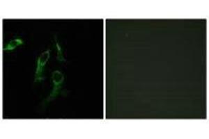 Immunofluorescence analysis of HepG2 ells, using HARS antibody. (HARS1/Jo-1 抗体  (C-Term))