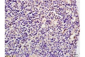 Immunohistochemistry (Paraffin-embedded Sections) (IHC (p)) image for anti-Solute Carrier Family 2 (Facilitated Glucose Transporter) Member 8 (SLC2A8) (AA 401-477) antibody (ABIN705746)
