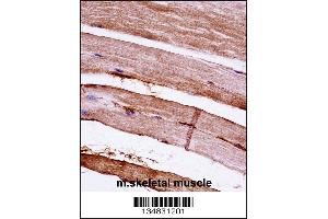 Mouse Mapkapk3 Antibody immunohistochemistry analysis in formalin fixed and paraffin embedded mouse skeletal muscle followed by peroxidase conjugation of the secondary antibody and DAB staining. (MAPKAP Kinase 3 抗体  (N-Term))