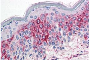 Skin, Human: Formalin-Fixed, Paraffin-Embedded (FFPE) (HTR2A 抗体  (N-Term))