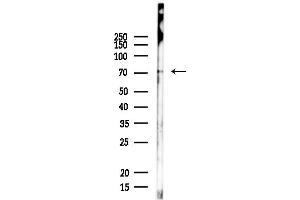 anti-Checkpoint with Forkhead and Ring Finger Domains (CHFR) antibody