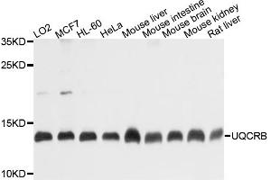 Western blot analysis of extracts of various cell lines, using UQCRB antibody (ABIN4905562) at 1:1000 dilution. (UQCRB 抗体)
