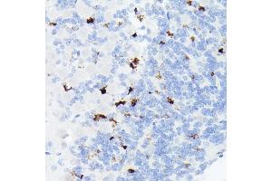 Immunohistochemistry of paraffin-embedded mouse brain using Somatostatin (SST) Rabbit mAb (ABIN7270492) at dilution of 1:1000 (40x lens). (Somatostatin 抗体  (AA 23-116))