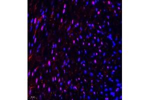 Immunofluorescence of paraffin embedded mouse heart using NSD3 (ABIN7076233) at dilution of 1:650 (400x lens) (WHSC1L1 抗体)
